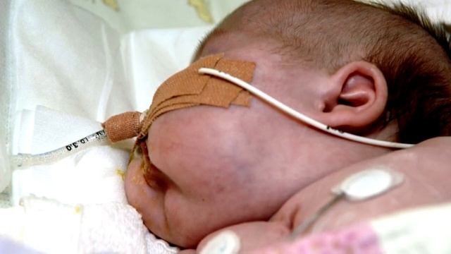 У девочки распухло лицо. Узнав диагноз родители не переставали кричать! смотреть онлайн