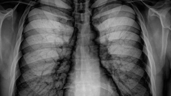 10 Inventions That Were Invented By Accident