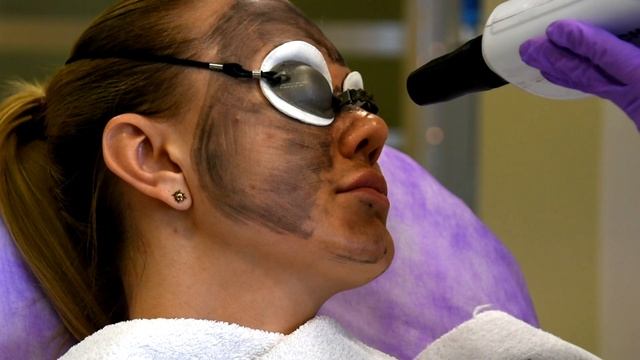 Карбоновый ПИЛИНГ - первое знакомство смотреть онлайн