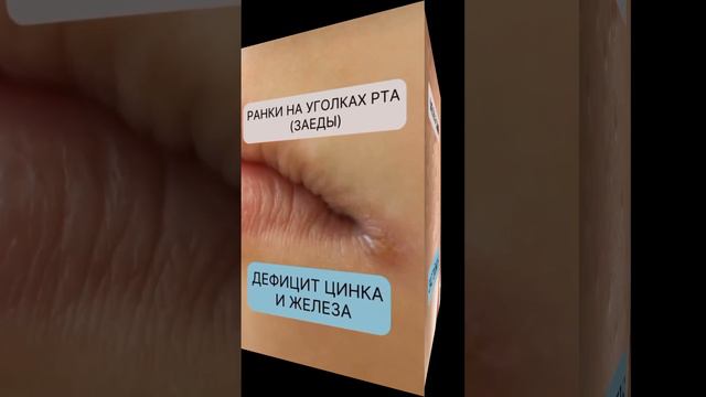 ПОДСКАЗКИ ОРГАНИЗМА смотреть онлайн