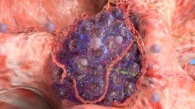 Lenf Bezleri Nedir? смотреть онлайн