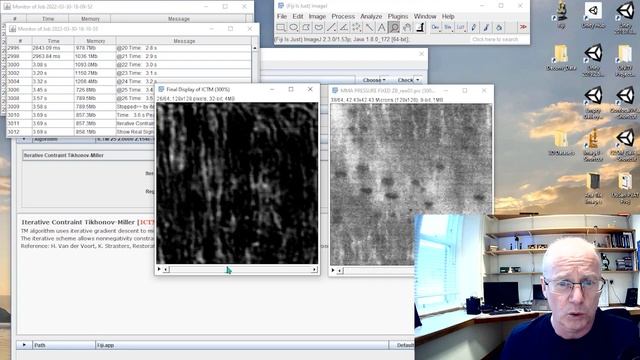 Fixing blurry images in Fiji/ImageJ (Deconvolution Lab2 plugin) смотреть онлайн