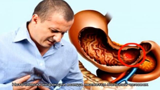 Кишечный грипп у взрослых