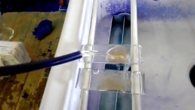 Perl's stain/Iron stain/Prussian Blue Reaction/Hematology/Special stain/STAR LABORATORY смотреть онлайн