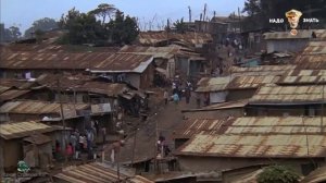 ПОЧЕМУ У АФРИКАНСКИХ ДЕТЕЙ БОЛЬШИЕ ЖИВОТЫ. Квашиоркор