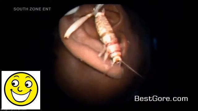 Cockroach in the ear! Таракан в ухе смотреть онлайн