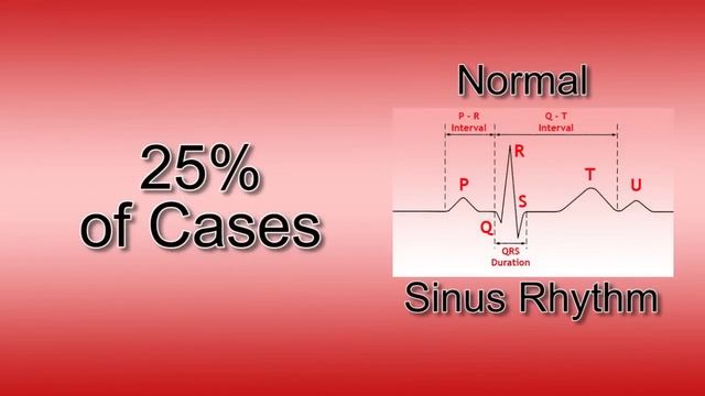 How to perform a vagal manoeuvre смотреть онлайн