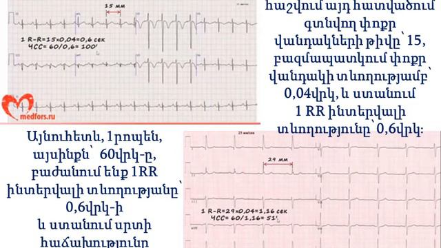 Դաս 9 5 ԷՍԳ։ Սրտի կծկումների հաճախության հաշվումը։ смотреть онлайн