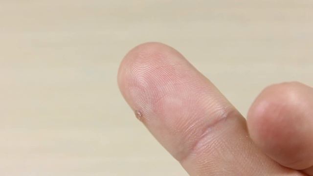 Самый Дешёвый и Простой Способ Избавиться от Бородавки смотреть онлайн