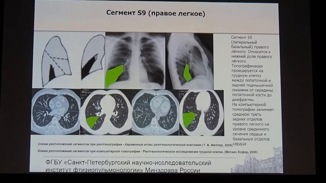 19 Гаврилов ПВ Торакальная радиология Сегментарная анатомия легких Классификация ВГЛУ смотреть онлайн
