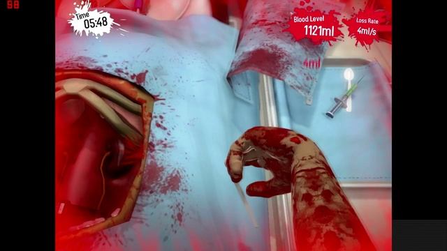 Surgeon Simulator - The kidney x2 - part 2 w/ 3rxxn смотреть онлайн
