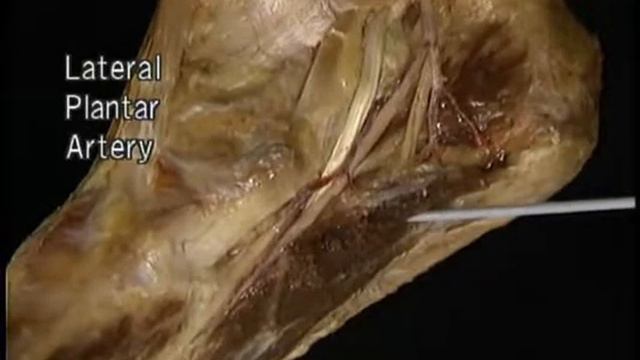 артерии стопы 2