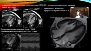 МРТ СЕРДЦА. Впервые в Краснодарском крае в Клинике Гиппократ ст. Ленинградская