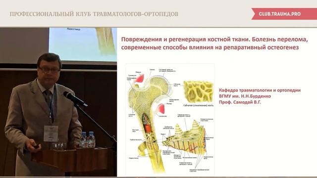 Современные представления о «болезни перелома» смотреть онлайн