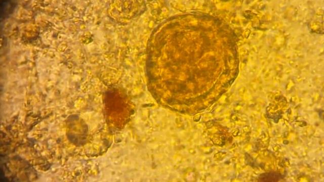 ГЛИСТЫ под окуляром микроскопа!!! смотреть онлайн