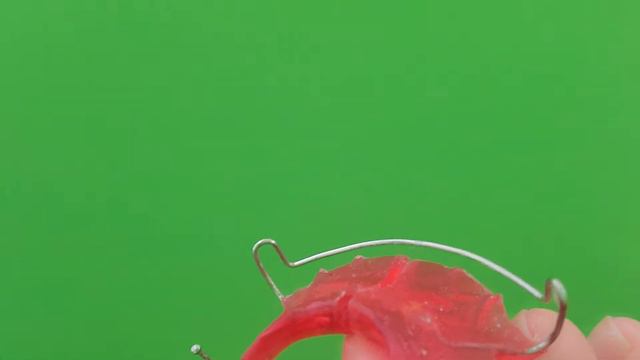 Adjust a Labial Bow in a Hawley смотреть онлайн