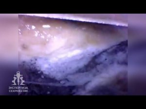 Поиск скрытой протечки эндоскопом