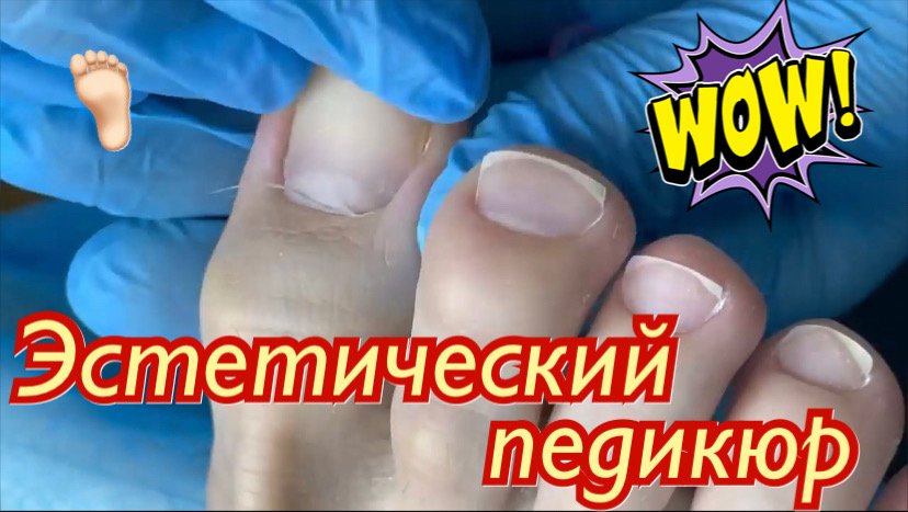 Эстетический педикюр???? смотреть онлайн