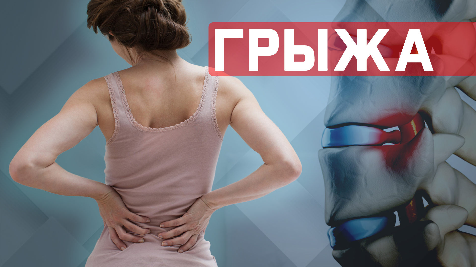 Упражнения при межпозвонковой грыже в пояснице. 2й - этап смотреть онлайн