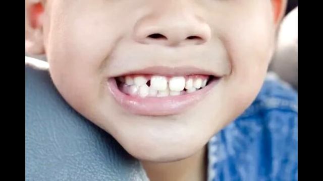 Саблиминал на восстановление зубов смотреть онлайн