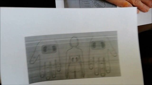 #2 ПДД: Поможем Друг Другу: Су Джок! Кашель и одышка! смотреть онлайн