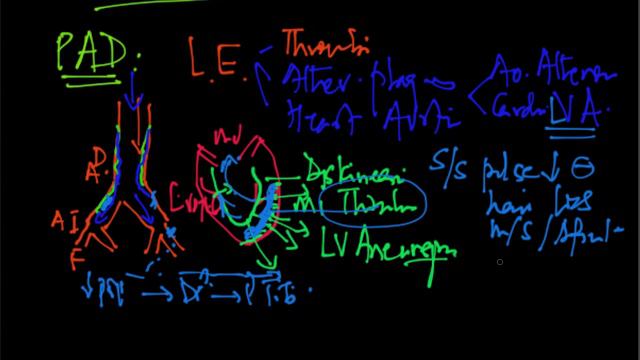 ^MuniHealth - #184 What Is Peripheral Arterial Disease (PAD)? - #Cardio360 Presents... смотреть онлайн