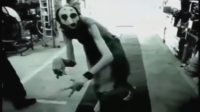 НЕ ДЛЯ СЛАБО НЕРВНЫХ!!! САМОЕ СТРАШНОЕ ВИДЕО!!!(синдром марфана) смотреть онлайн