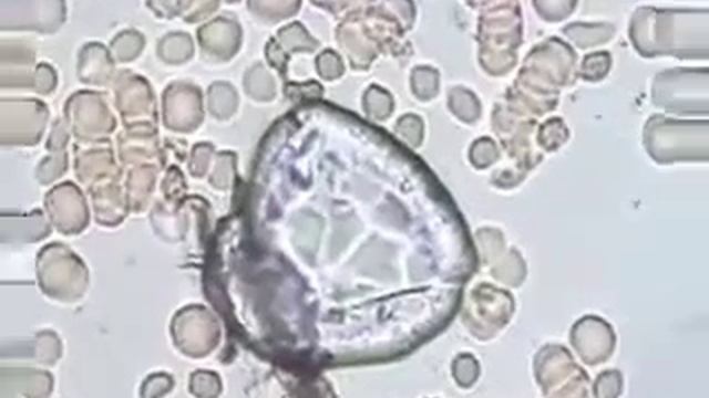 Так действует на кровь живая вода смотреть онлайн