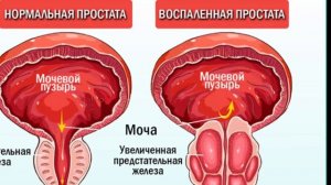 Вот что будет, если есть семена ТЫКВЫ каждый день. (Удивительно)