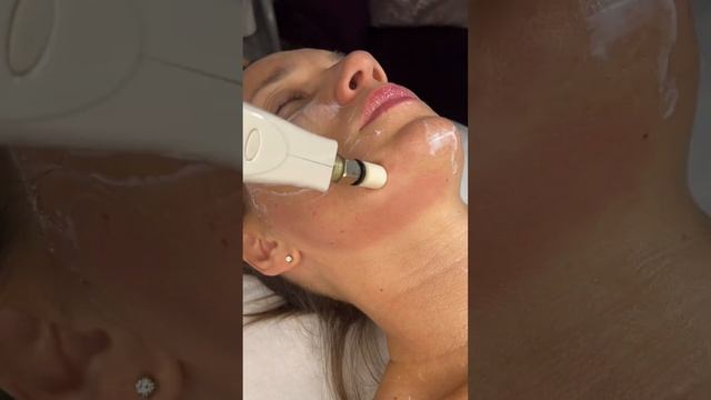 Вакуумной-роликовый массаж лица. LPG STUDIO Ольги Калининой ?