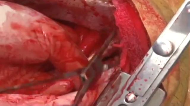 Тренажер акушерство и роды смотреть онлайн