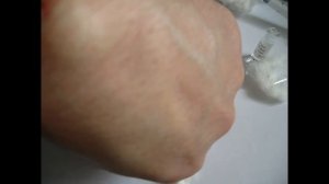 Сам себе доктор (Удаление гигромы 18+) / Be Your Own Doctor (removal hygroma 18+)