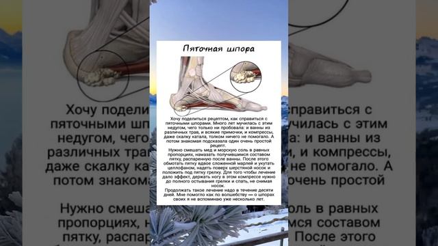 Лечение пяточной шпоры смотреть онлайн