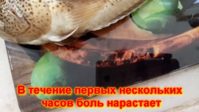 Эту рыбу боятся все! Морской дракон ядовитая рыба рыбалка в Турции подводная охота смотреть онлайн