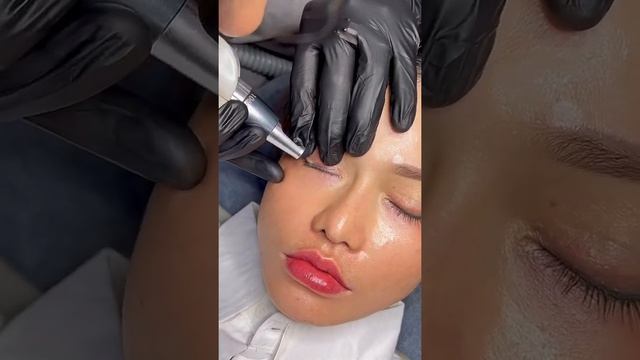 LASER MÍ MẮT XĂM HƯ - THẨM MỸ ĐÌNH TUYỂN - Phun xăm môi - Phun xăm chân mày - Xóa sửa chân mày смотреть онлайн