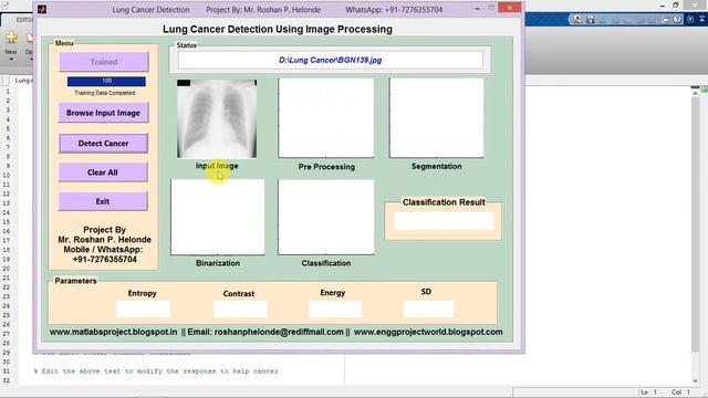 Lung Cancer Detection and Classification Using Matlab смотреть онлайн