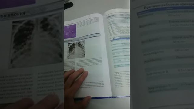 Обзор книги: Атлас грибковых заболеваний, спикер Дмитрий Азаровский смотреть онлайн