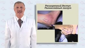 Переломы пяточной кости