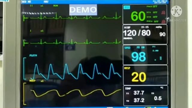 ICU,NICUPatient Monitor,How to use in life. सबो के लिए उपयोग जानना जरूरी । смотреть онлайн