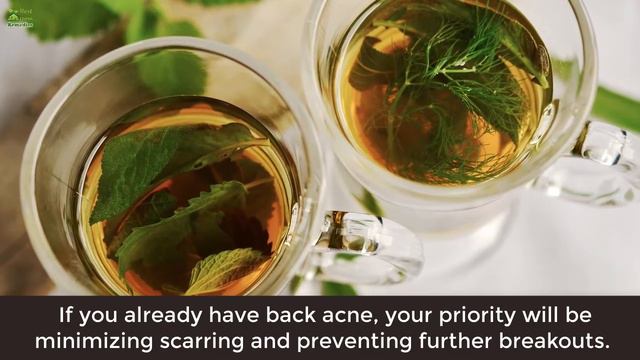 8 Effective And Easy Steps To Get Rid Of Back Acne Naturally | Best Home Remedies смотреть онлайн
