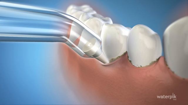 Waterpik Pik Pocket Tip - How to Use Guide for Australia & New Zealand смотреть онлайн