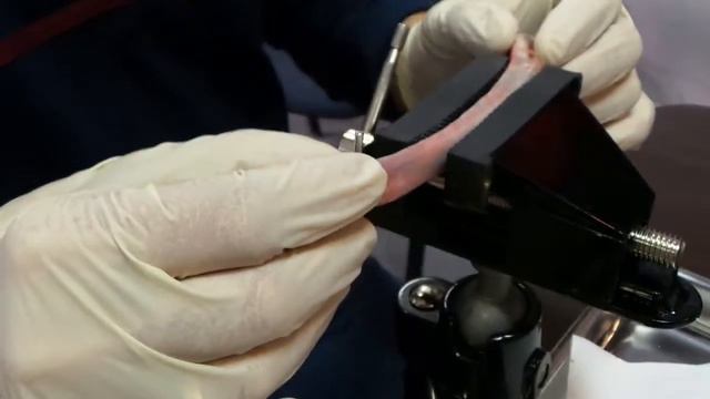 Установка Имплантата MeDent Delta смотреть онлайн