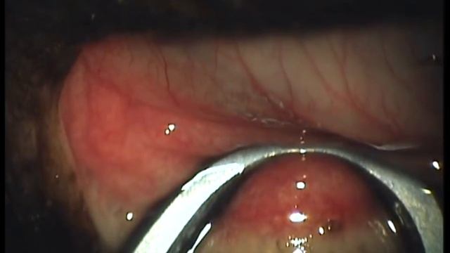 Эктопия ресницы у собаки. Удаление смотреть онлайн