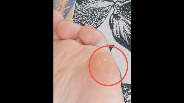 Не носите балетки! Делюсь горьким опытом спустя 4 лет носки смотреть онлайн