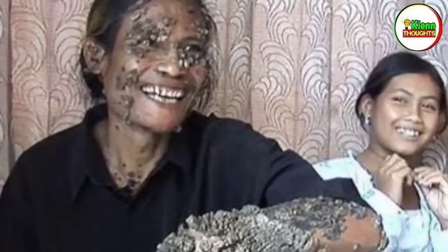 LALAKI SA JAVA, INDONESIA NAGING PUNO ANG KATAWAN | Kienn Thoughts смотреть онлайн