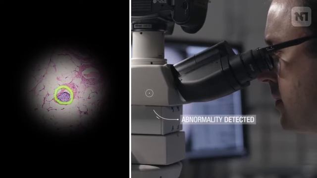 В Google создали компьютер, распознающий раковые клетки смотреть онлайн