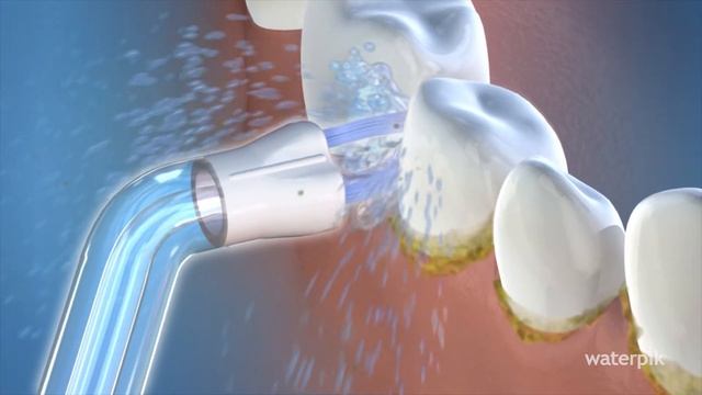 Jak działają końcówki do Irygatorów Waterpik? смотреть онлайн
