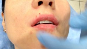 Практика ученицы по увеличению объема губ: Техника выполнения губ "ФРАНЦУЗСКИЕ ГУБЫ".