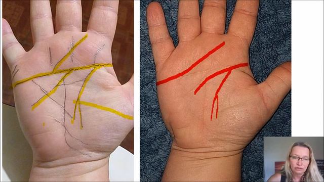 Right Hand Simian Line, Branch Lines From The Simian, Example Palm Reading