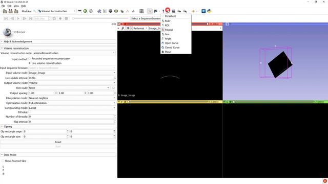 Real-time 3D ultrasound reconstruction using 3D Slicer + SlicerIGT смотреть онлайн